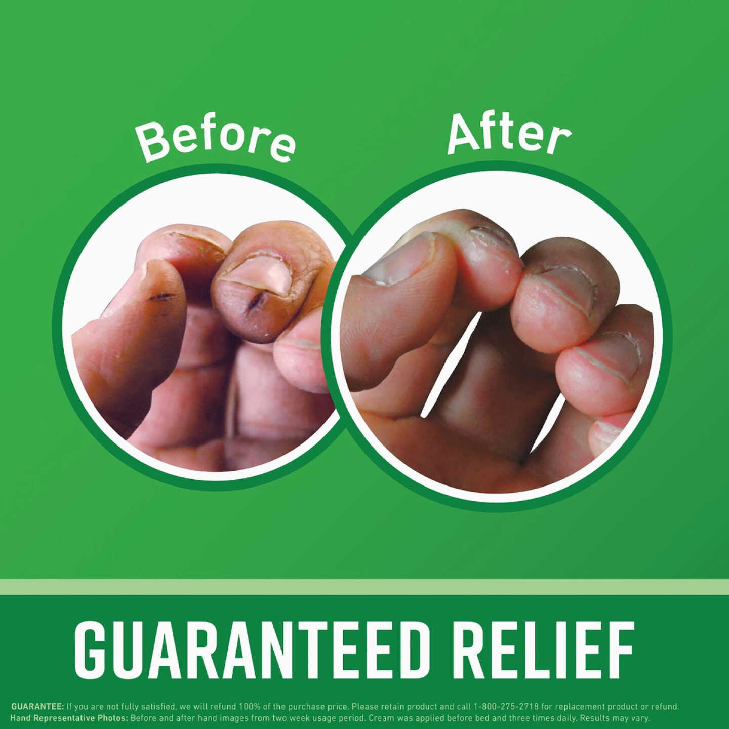 O'Keeffe's Working Hands 6.8 Oz. Jar Hand Cream Image 2