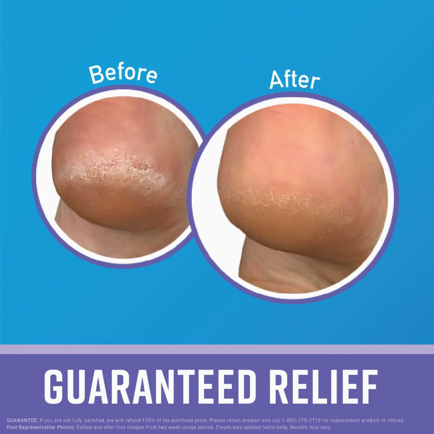 O'Keeffe's Healthy Feet 3 Oz. Night Treatment Lotion Image 2